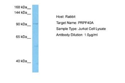 FNBP3 Antibody, Novus Biologicals 100 &mu;L; Unconjugated:Antibodies, Polyclonal